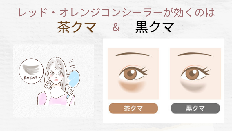 アラフィフ世代を悩ます目の下のクマは「茶クマ」と「黒クマ」。この2種類のクマはオレンジorレッド系コンシーラーでカバーできます！